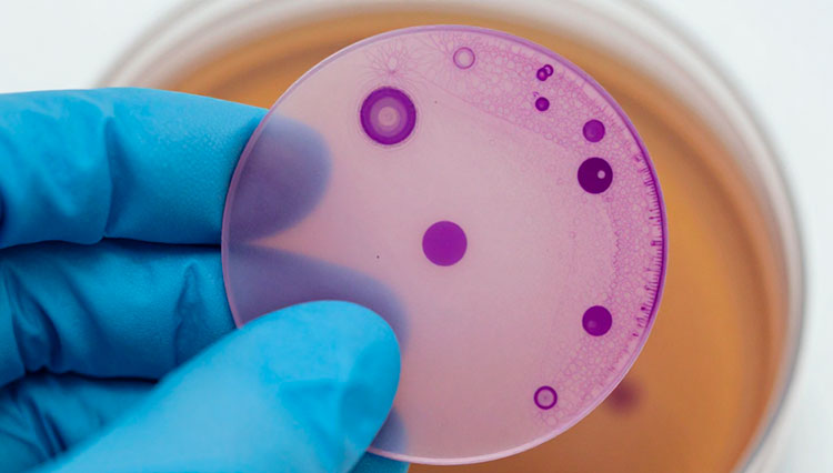 Перевод протокола гистологического исследования